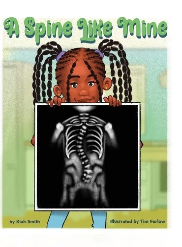 Kiah smith spine like - smith,